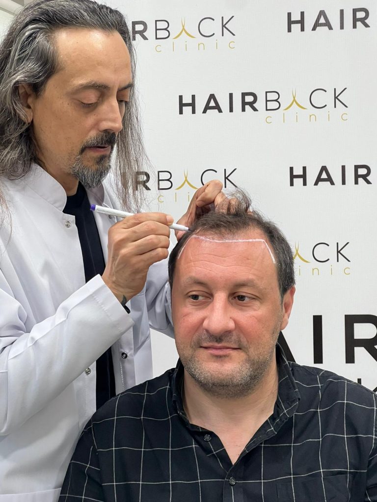 Dr Baykal Oymak greffe de cheveux en Turquie
